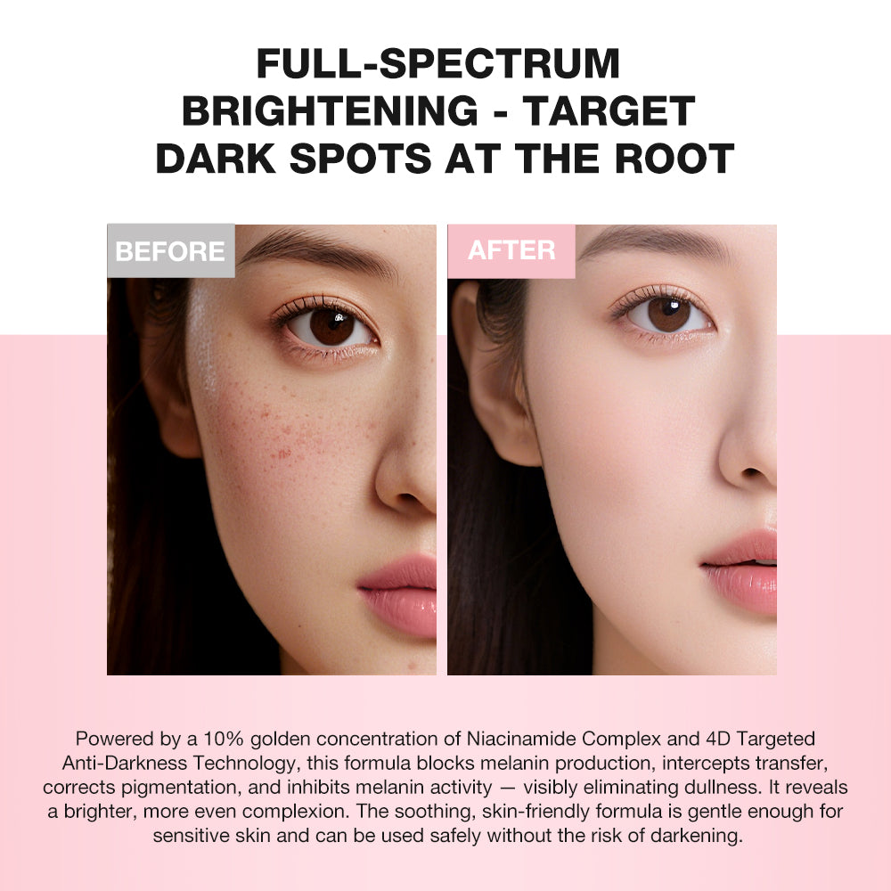 10% Niacinamide Dark Spot Fighting Cream