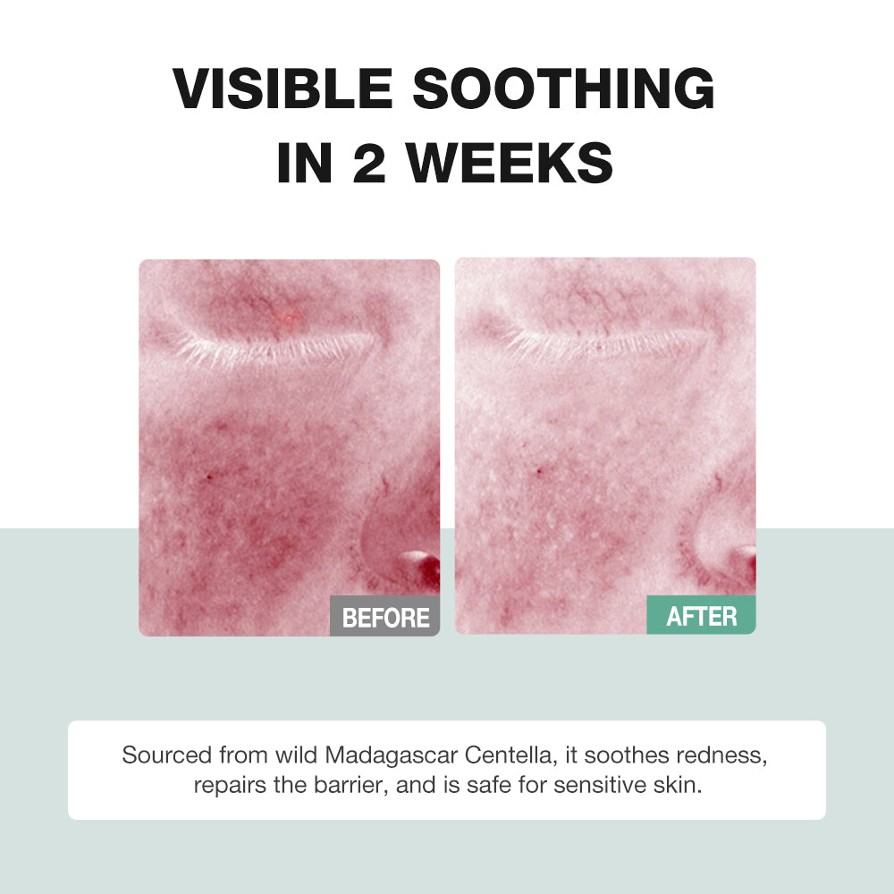 Centella Triple Strength Skin Soothing Serum