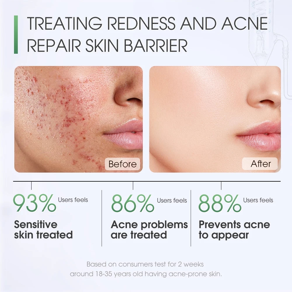 Redness Relief Centella Skin Soothing Masque