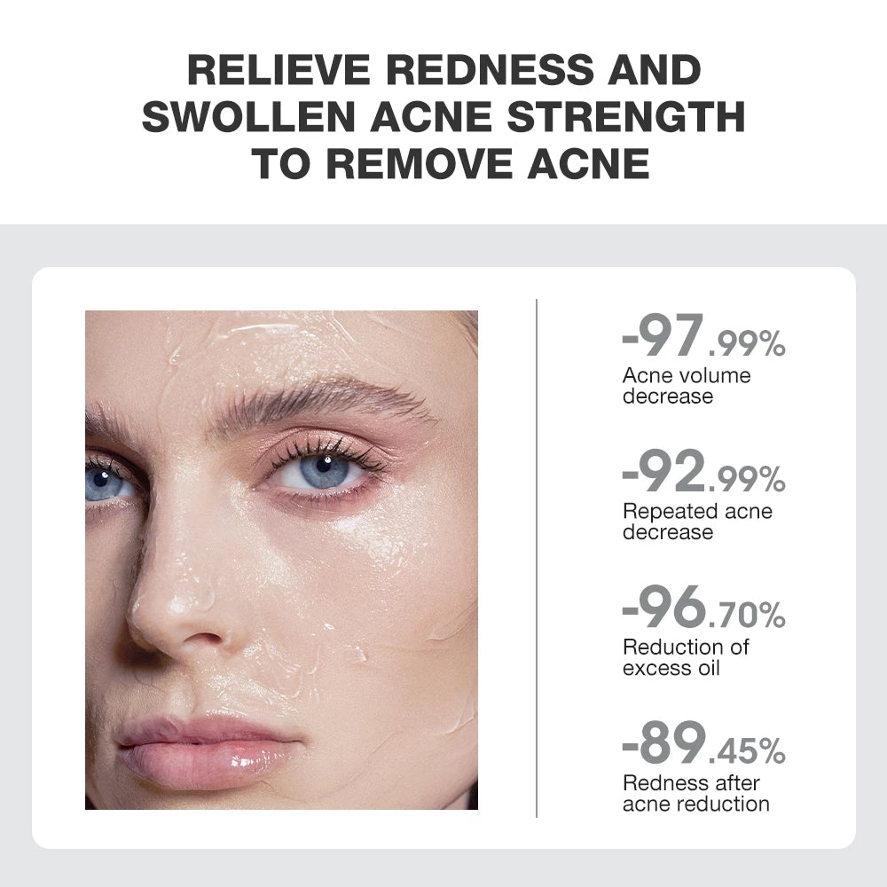 Overnight Acne Treatment Ice Sleep Masque