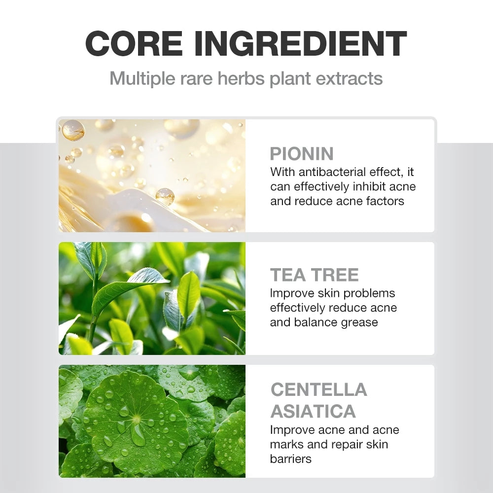 Overnight Acne Treatment Ice Sleep Masque