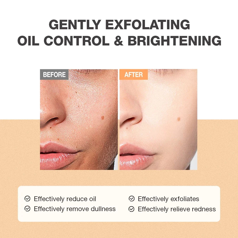 Exfoliating Salicylic Acid Refreshing Scrub Cleanser