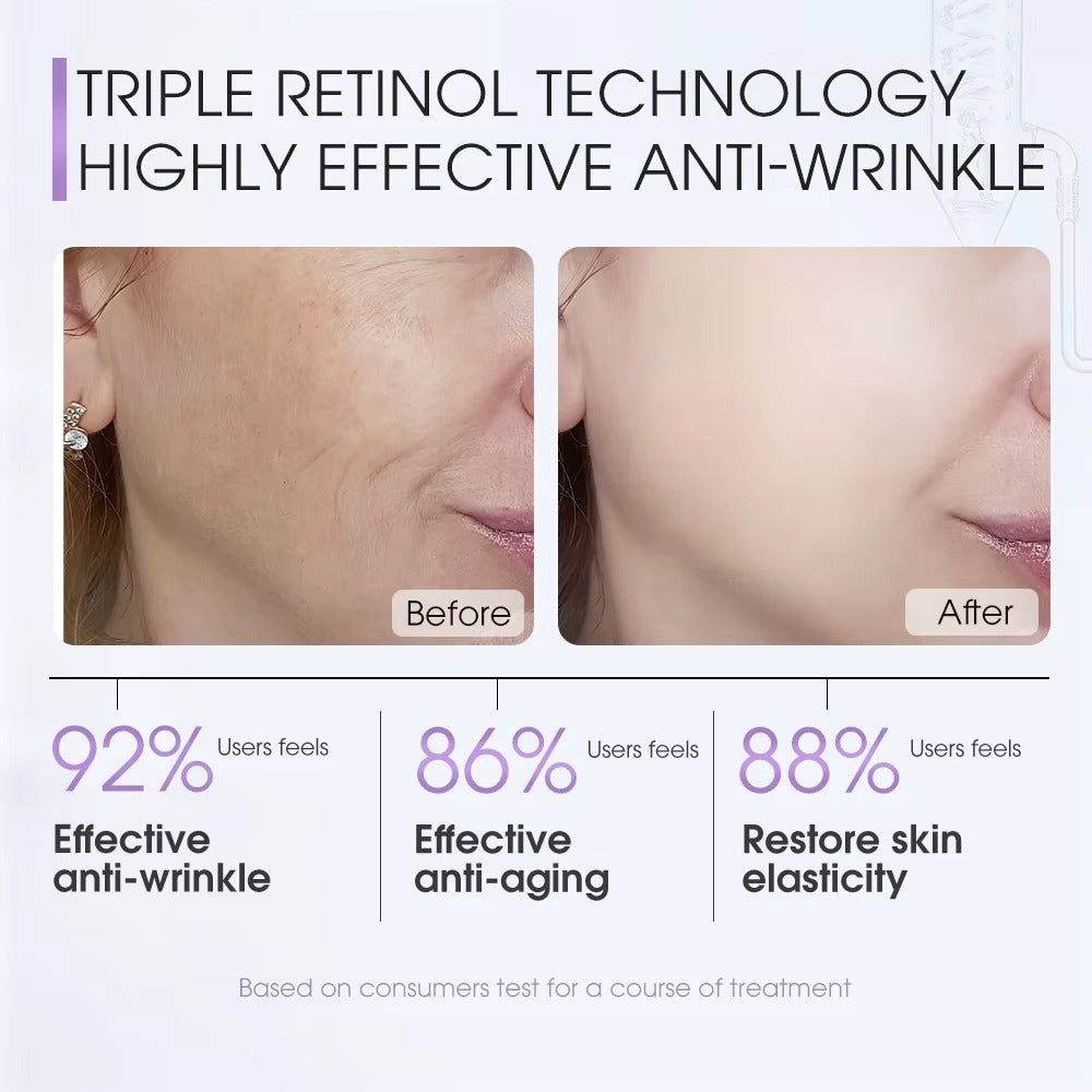 3A Advanced Retinol Skin Renewal Serum