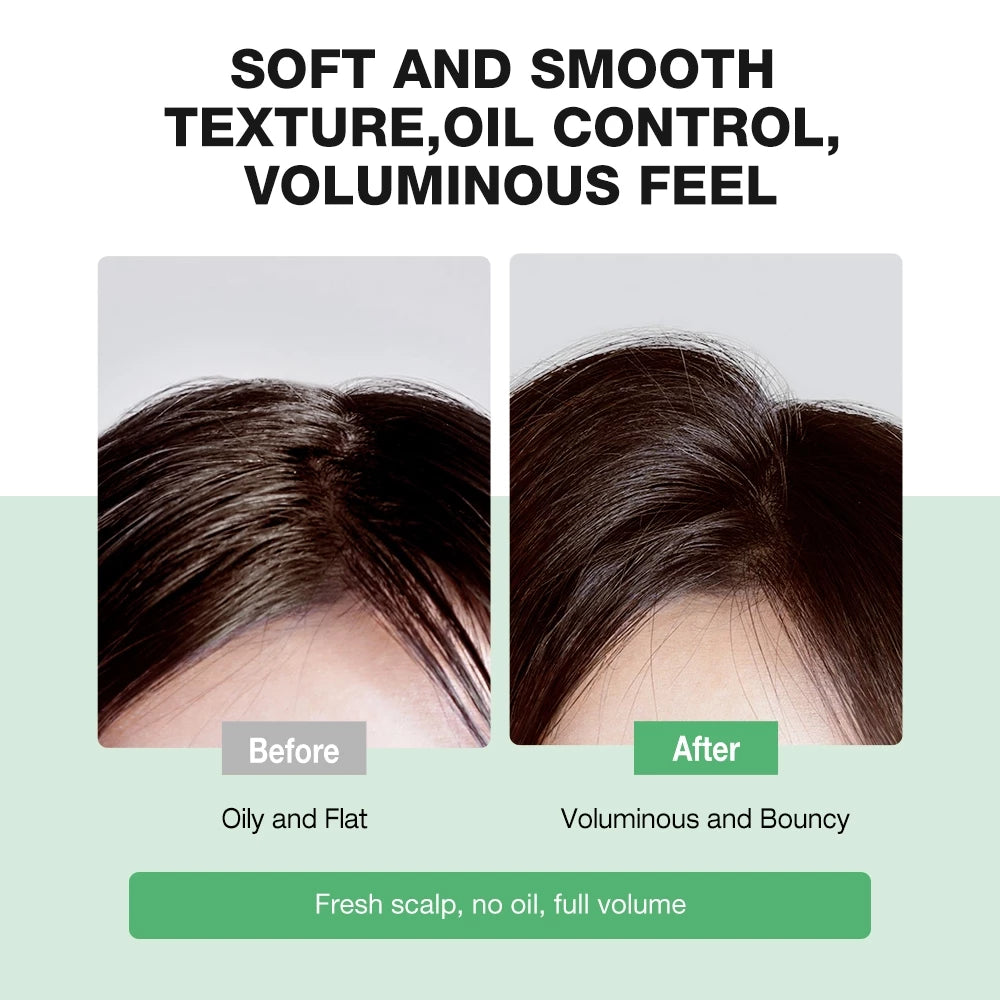 10X Amino Acid Oil Control Volumizing Shampoo