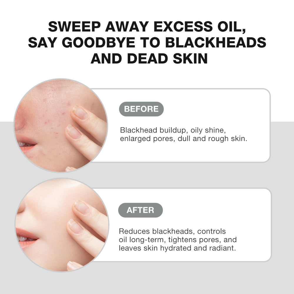 Salicylic Acid Deep Pore Cleansing Masque