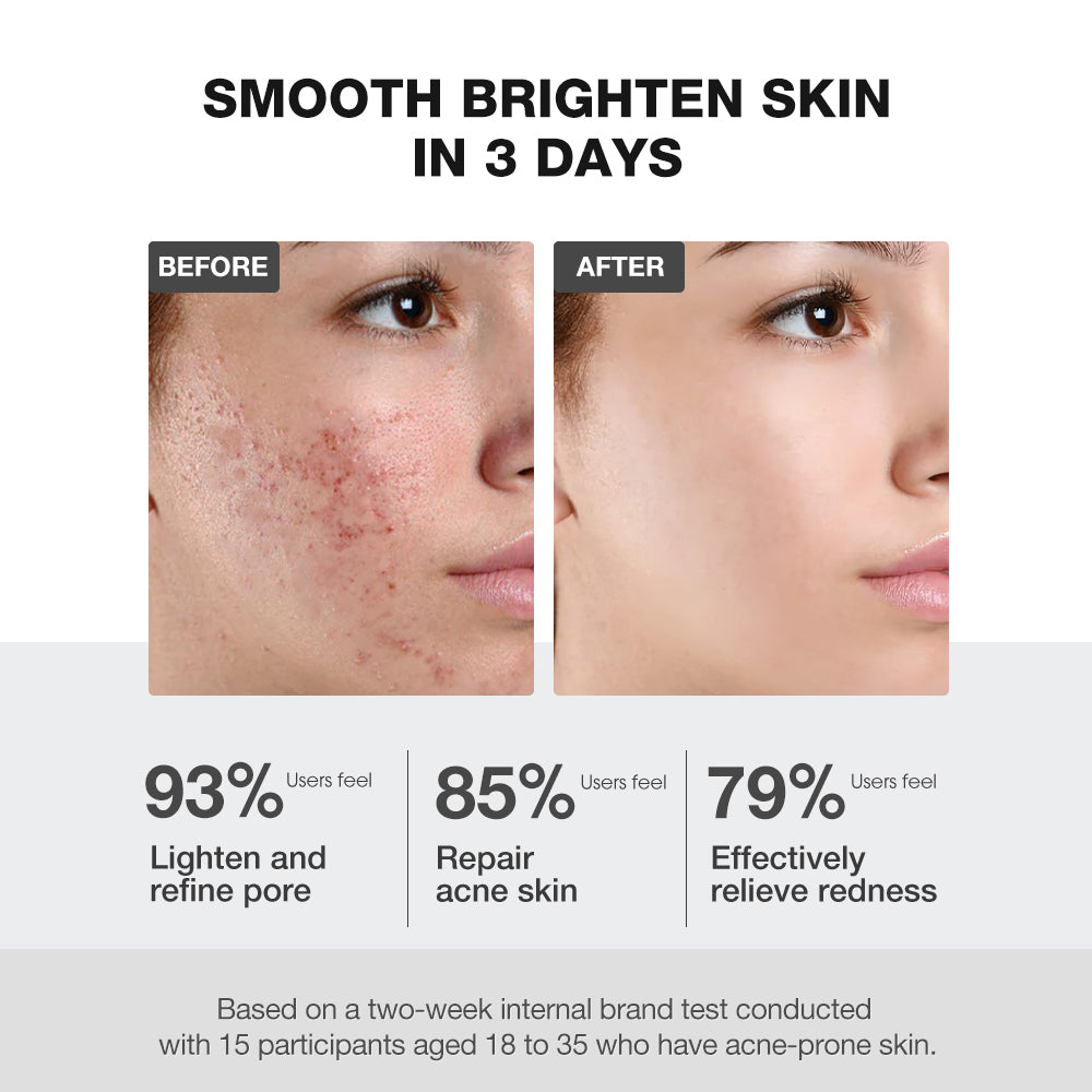 Salicylic Acid Deep Pore Cleansing Masque