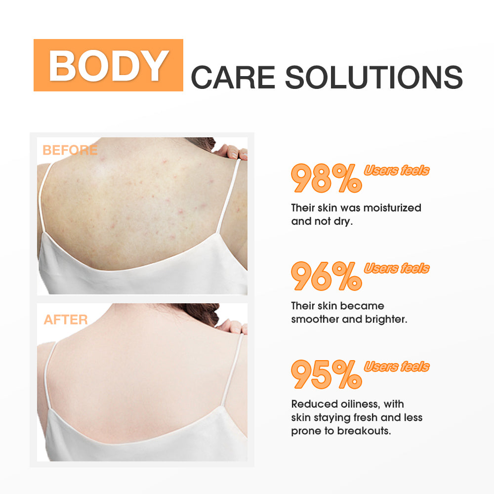 Calming Salicylic Acid Exfoliating Body Lotion