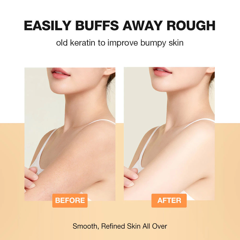 Salicylic Acid Gentle Exfoliating Body Scrub