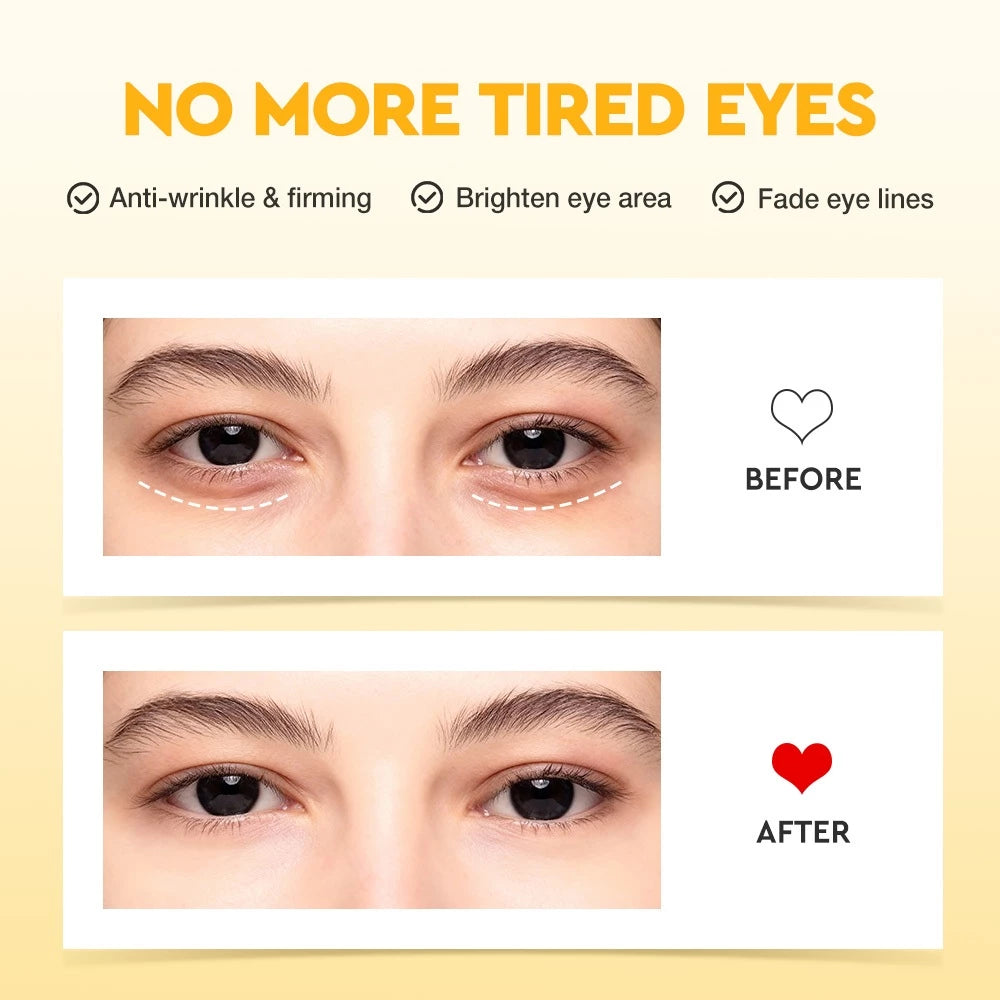 5X Vitamin C Under Eye Brightening Cream