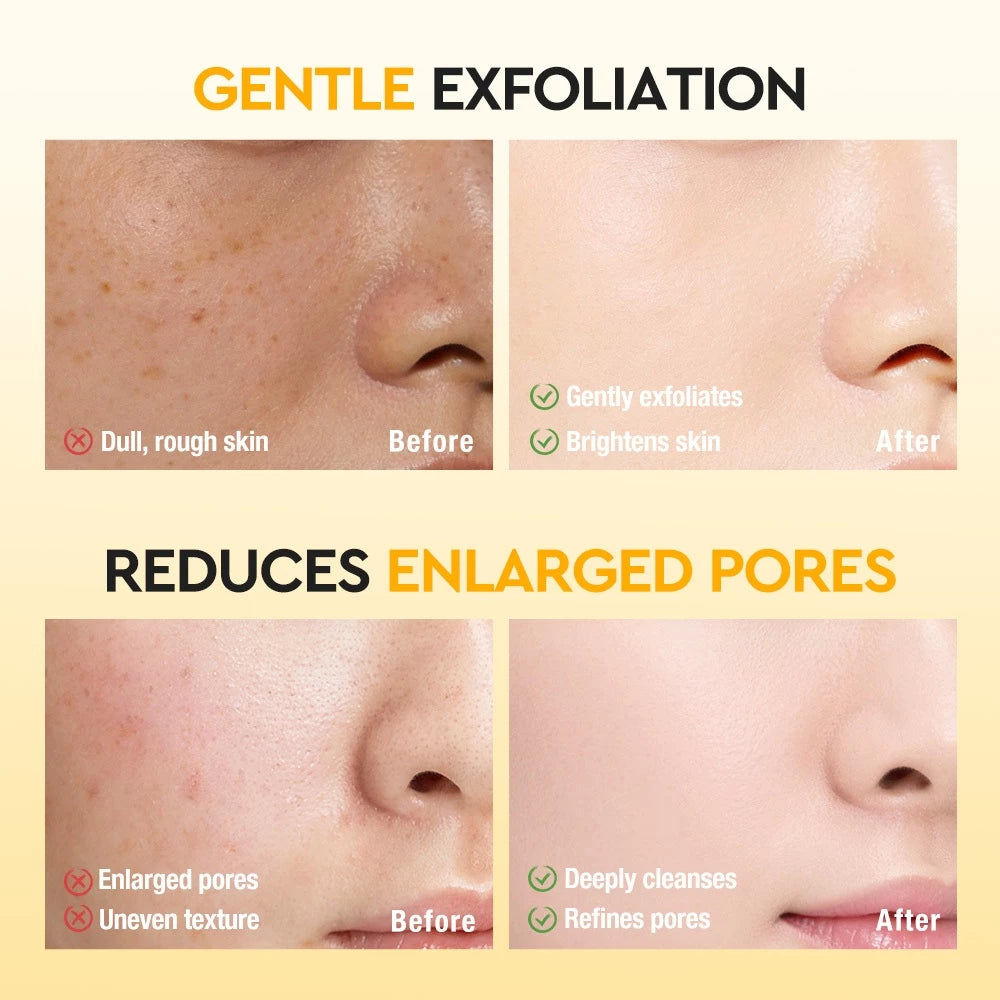 5X Vitamin C Purifying Bubble Mask (10 Pack)