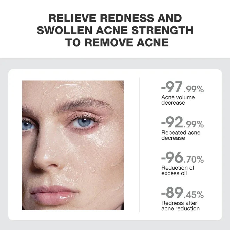 Overnight Acne Treatment Ice Sleep Masque