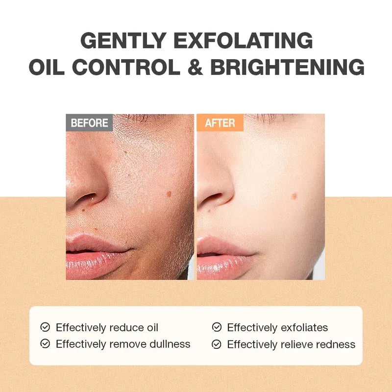 Exfoliating Salicylic Acid Refreshing Scrub Cleanser