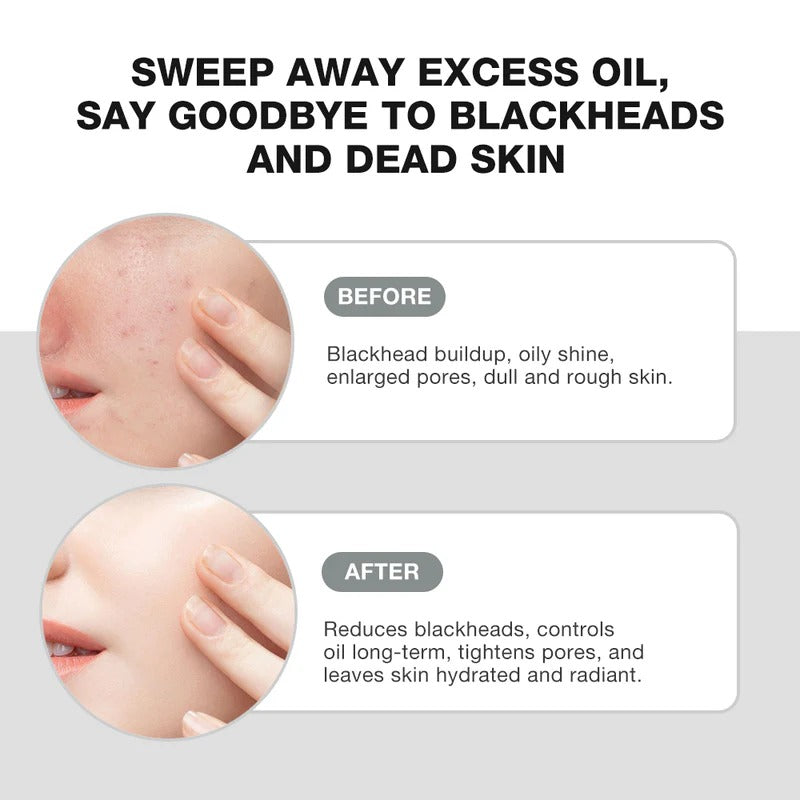 Salicylic Acid Deep Pore Cleansing Masque