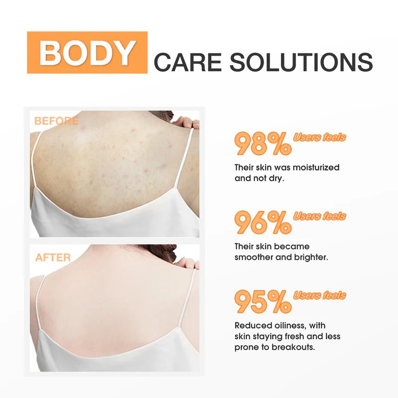 Calming Salicylic Acid Exfoliating Body Lotion