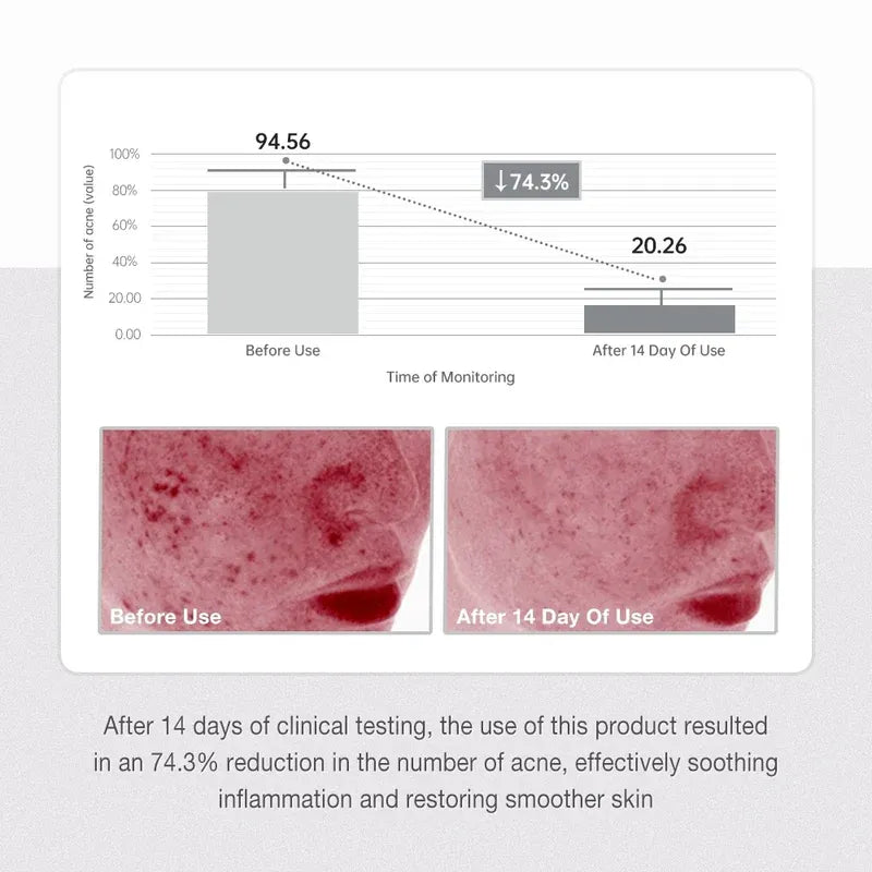 Repairing Salicylic Acid Anti Acne Serum