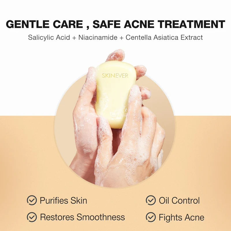 Purifying Salicylic Acid Acne Control Soap