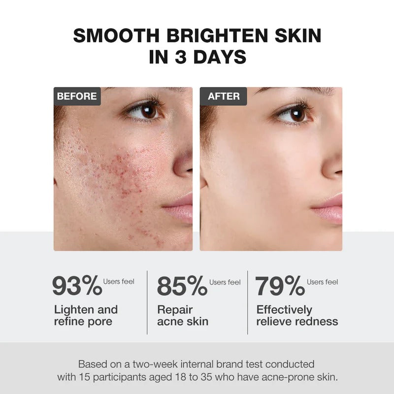 Salicylic Acid Deep Pore Cleansing Masque