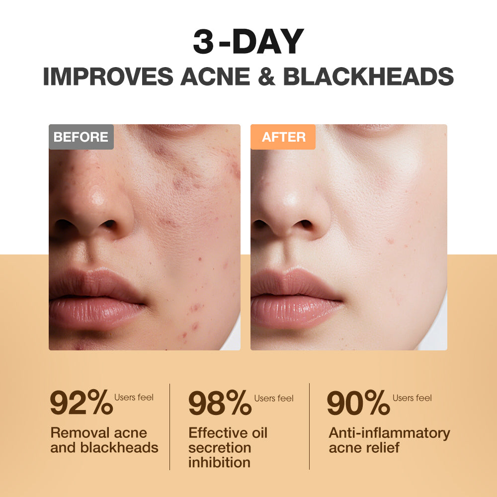Acne Fighting Salicylic Acid Toner Pads