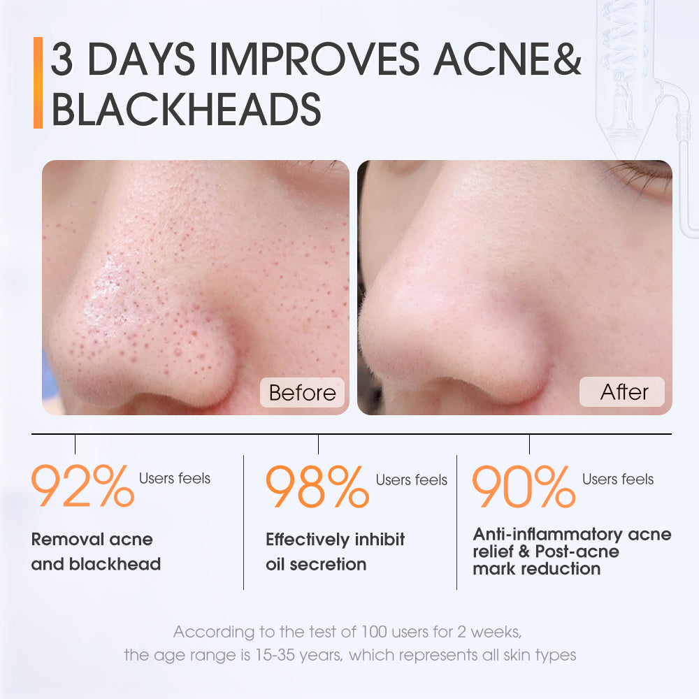 Acne Clearing Salicylic Acid Toner Pads
